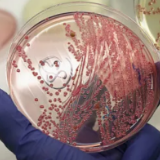 美国已累计报告84例大肠杆菌感染者 快餐巨头温蒂汉堡配合调查