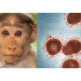 巴西猴痘死亡病例增至11例
