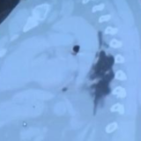 新冠疫情失控、压力前所未有 美国ICU护士:这一年像在地狱里一样