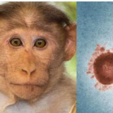 注猴痘疫情 世卫组织：全球已上报超过7万例猴痘病例