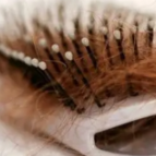 专家提醒  患者遇脱发困扰应及时就医