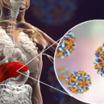 新闻提示 肝癌有家族聚集性 重视乙肝早期治疗