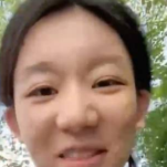 女孩乐观面对脸上疤痕