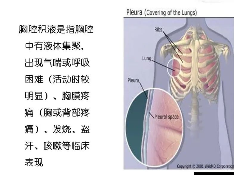 肋骨骨折后应该怎么做？株洲市中医伤科医院支招