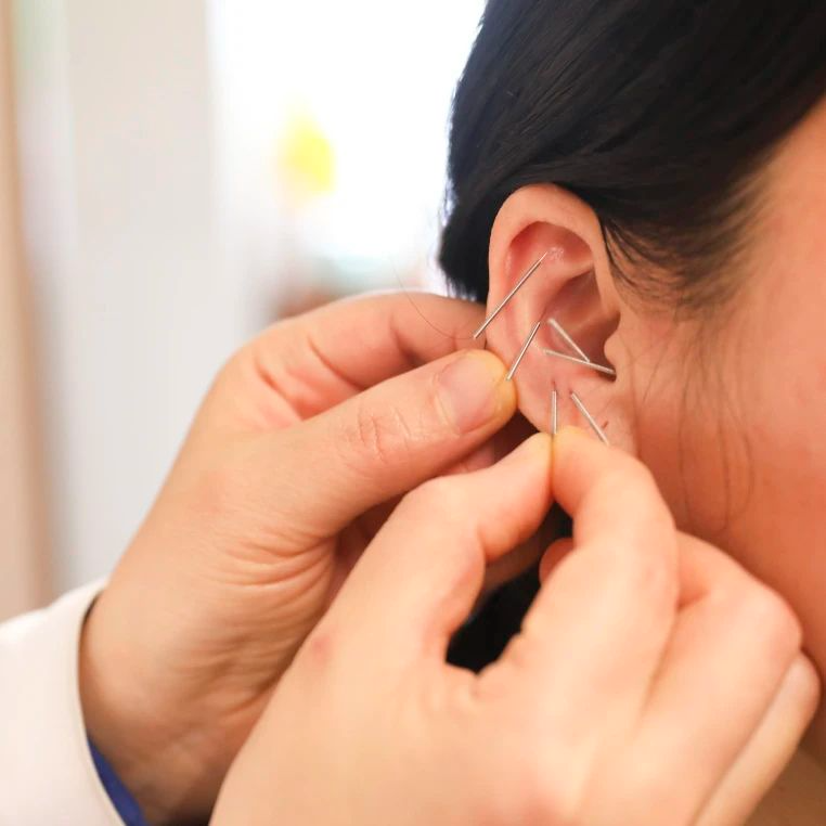 健康科普丨耳穴疗法改善患者“头疼”症状