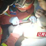 湖南攸县一男孩“小勾勾”被拉链“咬”住 消防员及时救助