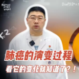 健康科普｜肺癌是如何演变的？看它的变化就知道了