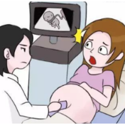 胎儿脐带绕颈5周险窒息 做好这一件事可预防