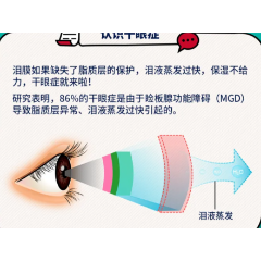 健康科普｜睑板腺功能障碍型干眼症物理治疗方法