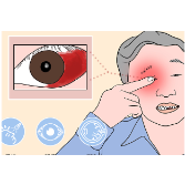 健康科普丨株洲市中心医院：眼睛出血了怎么办？