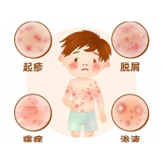 健康科普丨宝宝总挠皮肤？这不是普通“湿疹 ”
