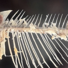 健康科普|鱼刺卡喉别乱来,正确处置牢记三步走