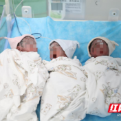 三胞胎共用一胎盘，高危产妇在醴陵成功分娩