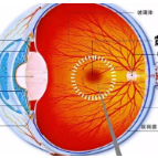 为什么要进行眼底检查，眼底检查到底能查出什么？