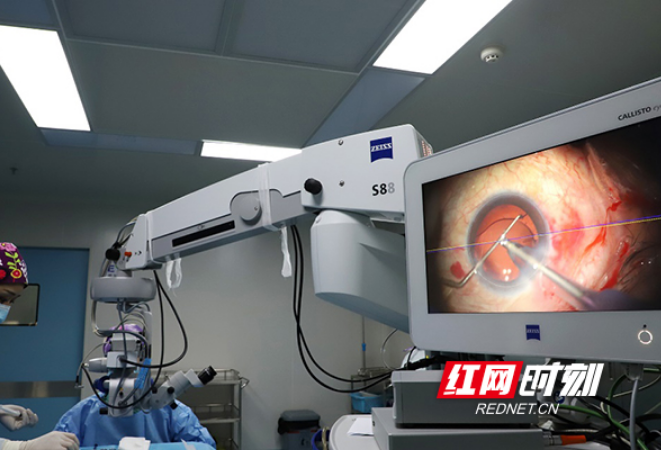 衡阳首台！爱尔眼科开展导航手术显微镜下散光人工晶体植入手术