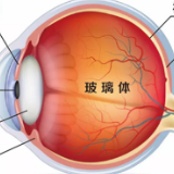 眼睛红就是“红眼病”？15岁少年患上这种致盲性眼病