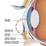 7岁男童总爱揉眼，原来是睫毛“倒着长”