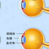 眼前总有“蚊子”在飞？这5种状况得及时治疗！