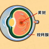  “阳康”后感觉眼睛不适？眼底检查及时做！