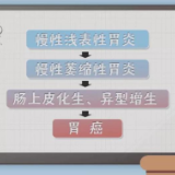 这种癌爱找年轻人！看看这些坏习惯你中招了吗？