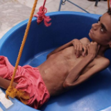 联合国报告：2019年以来，全球新增1.22亿饥饿人口