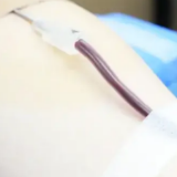 献血年龄拟延长至65周岁 献血法修订草案公开征求意见