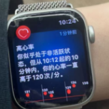 有一种焦虑叫“手表说我没睡好” 别让智能穿戴设备取代医生诊断