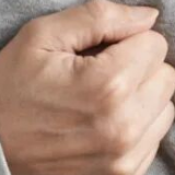 嘴唇发紫是心脏不好?更重要的是看这一点