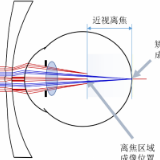 疫情学习娱乐用眼忙 近视防控有绝招