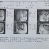 腹痛非小事 小心是藏在深处的肿瘤信号