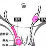 家有男宝 谨防其有“蛋蛋”的忧伤