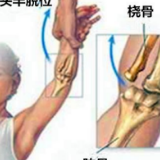 大手拉小手 竟拉出“牵拉肘”？