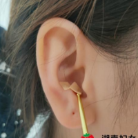 阳后浑身疼 这份“减痛”指南请收好！