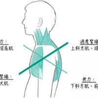 关注儿童体态，让孩子少走“弯”路