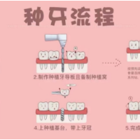 种植牙价格更“亲民”，但这些流程必知晓！