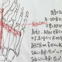 修足适履，大脚骨的“小解决”