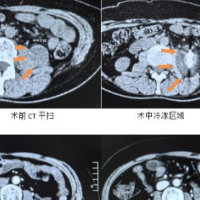 一面锦旗展医术精湛 声声感谢道医患情深