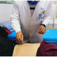 腹针疗法：安全无痛的新选择