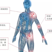 疼痛、损伤、关节炎，可以用自己的血治自己的病？