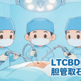 胆管取石不留管 微创新术式为患者重塑无负担康复体验