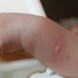 嗡~~啪!今年长沙蚊虫密度大增,你家这些地方该清清了!