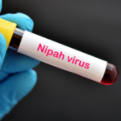 “致命尼帕”会全球流行吗?该如何防护?
