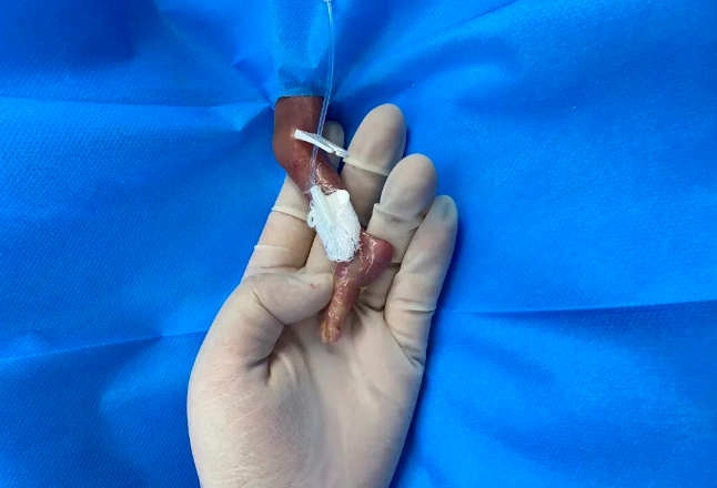 出生体重不足1斤，湖南胎龄最小宝宝出院啦！