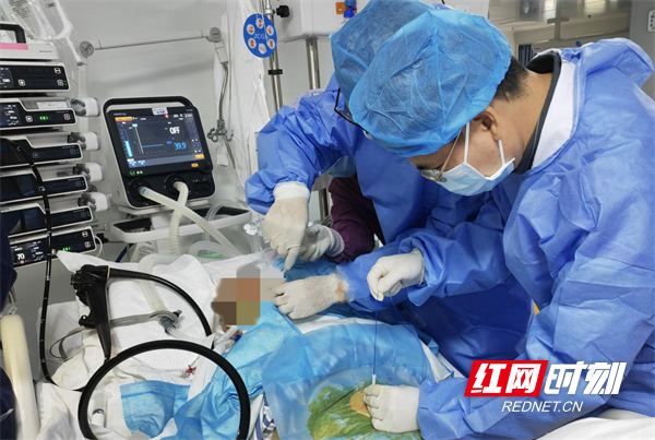 “镜”准治疗  一步到“胃” 郴州市第四人民医院成功开展经皮内镜下胃造瘘术