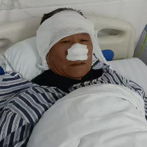 嘉禾县七旬老党员曾凡林：“我这一点伤痛，根本不值一提” 