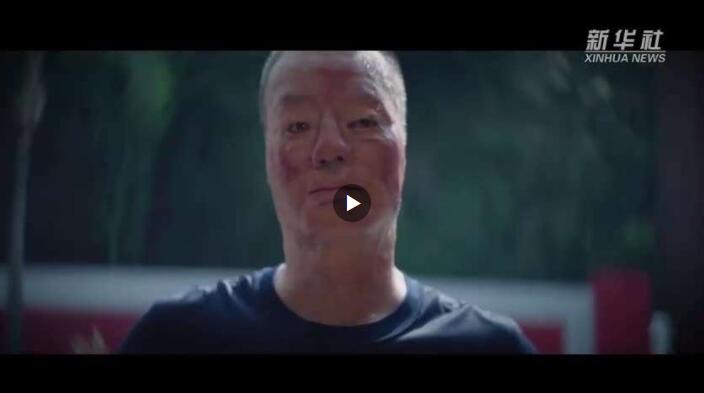 消防员救火被烧伤毁容网友世界上最美的脸