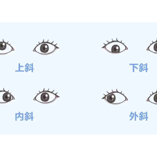 拖延十余年、差点毁掉参军梦！衡阳19岁男孩患上复杂斜视