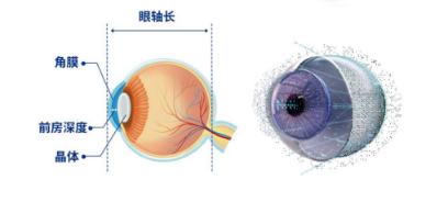 每天盯屏8小时的衡阳影像科医生，全光塑术后找回“4K”视界
