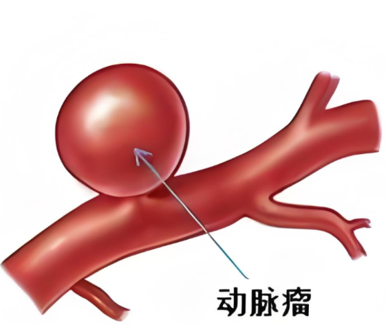 颅内“炸弹”成功拆除!专家妙手助精神障碍患者重获新生