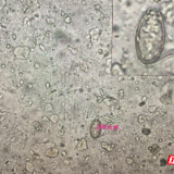 健康科普丨这些美食暗藏杀机,医生提醒:别让“鲜味”变“险味”!